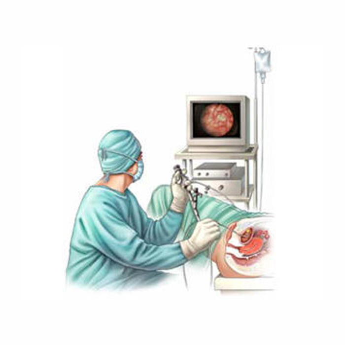 Resección en bloque de tumor de vejiga